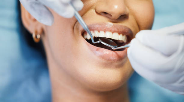 Best Emergency Treatment for Dental Infections or Abscesses in Coulee Dam, WA