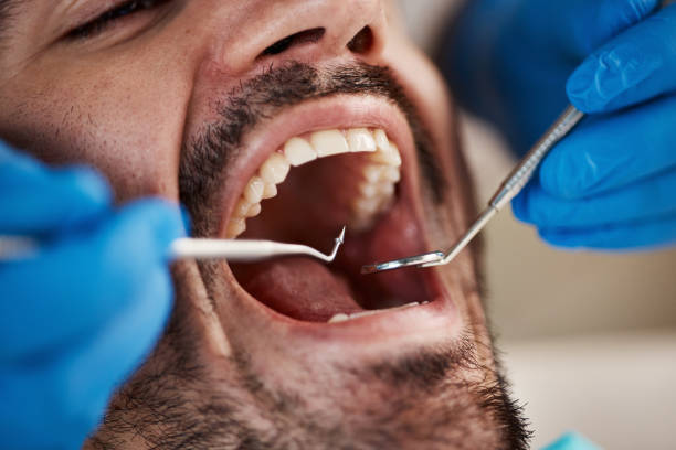 Best Urgent Care for Lost Fillings or Crowns in Coulee Dam, WA